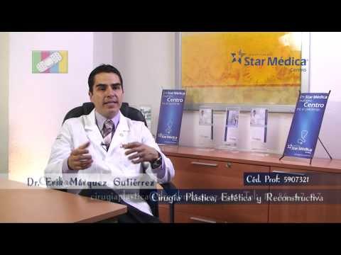 ¿Qué pacientes son candidatos a realizarse una liposucción?