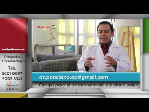 ¿Cuándo es necesaria una cirugía para el tratamiento del pie plano valgo?
