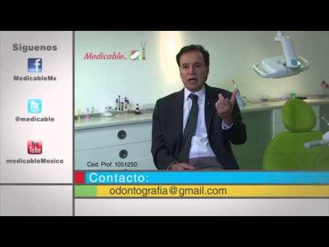 En los dientes permanentes, ¿también se pueden encontrar células madre o sólo en los primarios?