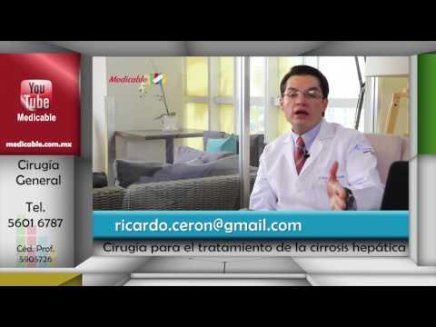008 CUANDO ES NECESARIA UNA CIRUGIA PARA EL TRATAMIENTO DE LA CIRROSIS HEPATICA