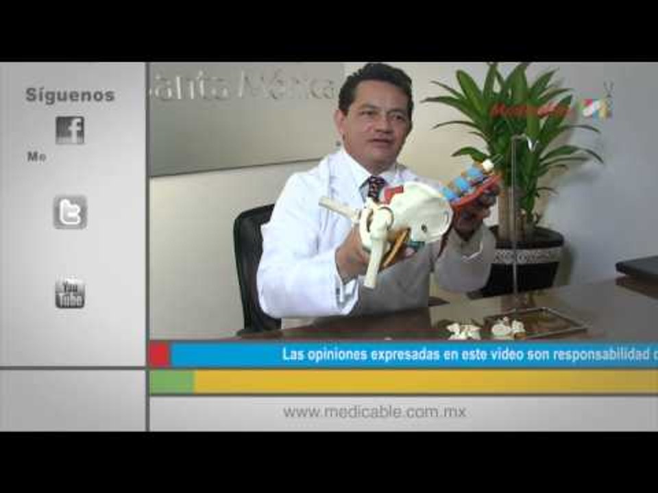 ¿Cómo puedo prevenir el dolor de ciática?