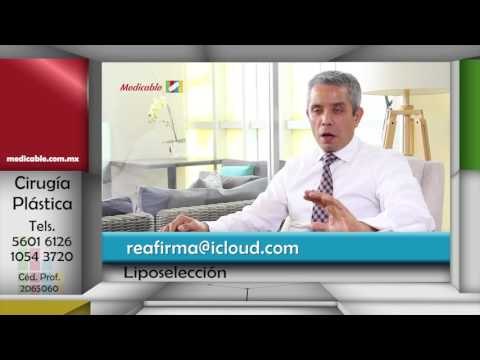 018 TODOS LOS CIRUJANOS PLASTICOS REALIZAN LA LIPOSELECCION