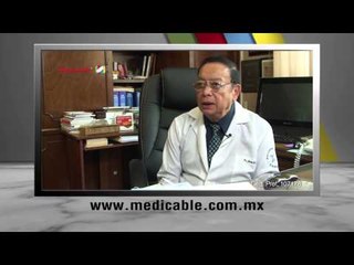 ¿Cómo se trata el Alzhéimer?