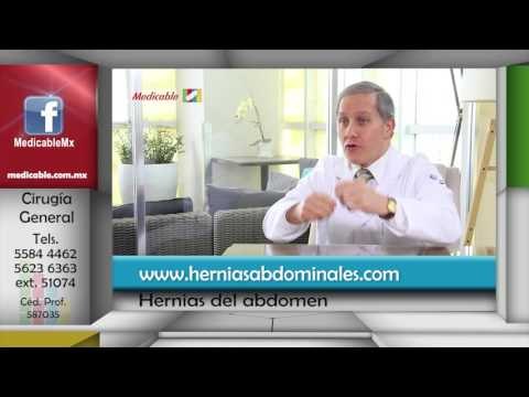 007 QUE OPCIONES DE TRATAMIENTOS EXISTEN PARA LAS HERNIAS DEL ABDOMEN
