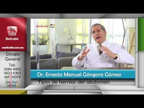 002 CUALES SON LOS TIPOS DE HERNIAS DEL ABDOMEN