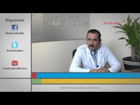 ¿Cuál es el tratamiento que debo seguir si tengo varices?