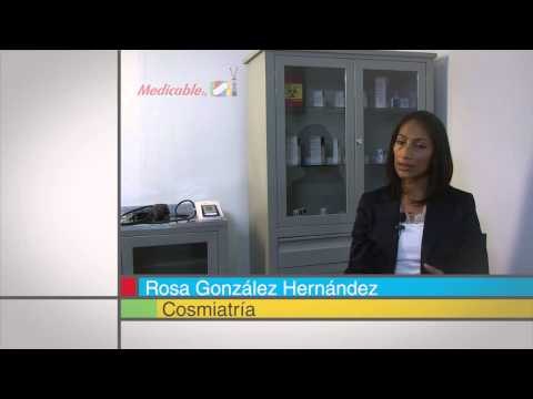 Retirar las pecas o los lunares, ¿puede generar cáncer?