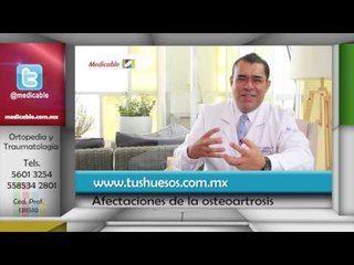010 COMO SE AFECTA LA CALIDAD DE VIDA CON LA OSTEOARTROSIS