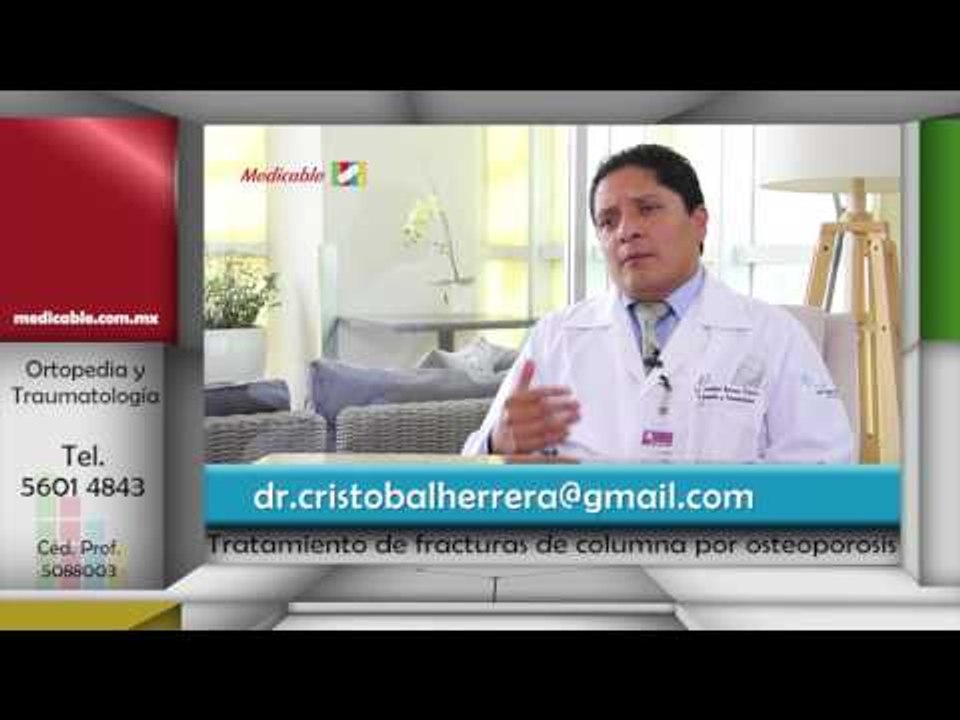 005 QUE OPCIONES DE TRATAMIENTOS EXISTEN EXISTEN PARA LAS FRACTURAS DE COLUMNA POR OSTEOPOROSIS
