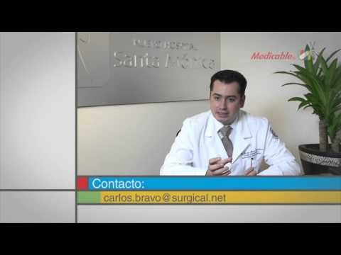 Dentro de la cirugía bariátrica, ¿cuáles son las alternativas para bajar de peso?