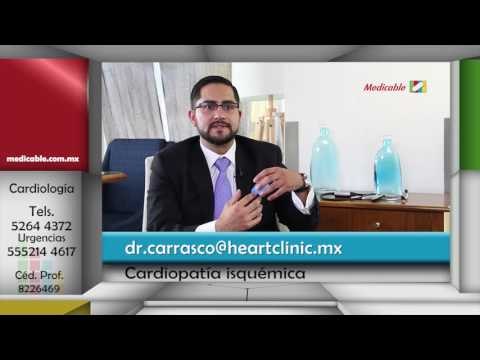 ¿La cardiopatía isquémica es causa de arritmias cardíacas?