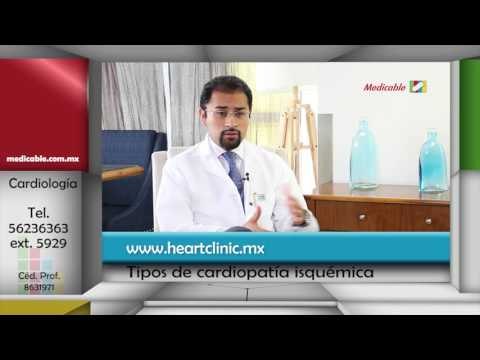 ¿Cuántos tipos de cardiopatía isquémica hay?