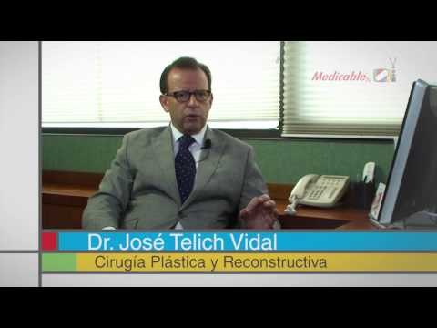 ¿En qué consiste el tratamiento con toxina botulínica para la hiperhidrosis?