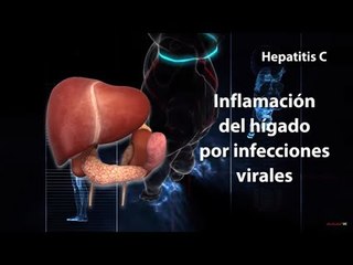 HEPATITIS C - DR. MAURICIO CASTILLO BARRADAS