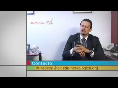 Dolores de cabeza muy frecuentes y de larga duración, ¿es indicio de un tumor cerebral?