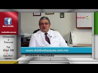 ¿Cómo se manifiesta la infección en una prótesis?