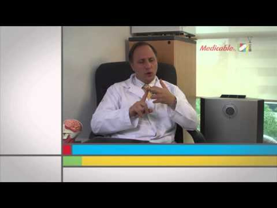 ¿Qué factores de estilo de vida influyen para desarrollar un evento cerebrovascular?