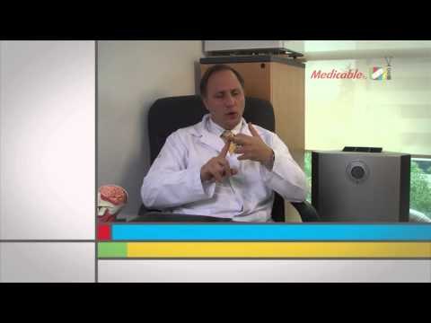 ¿Qué factores de estilo de vida influyen para desarrollar un evento cerebrovascular?