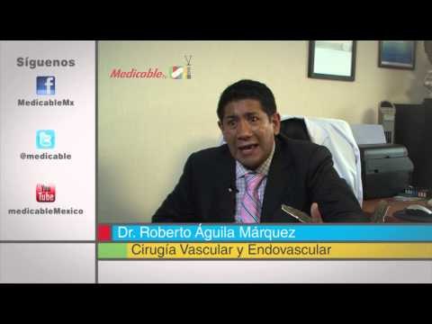 ¿Cuándo es necesario acudir a un profesional médico si se padece trombosis venosa profunda?