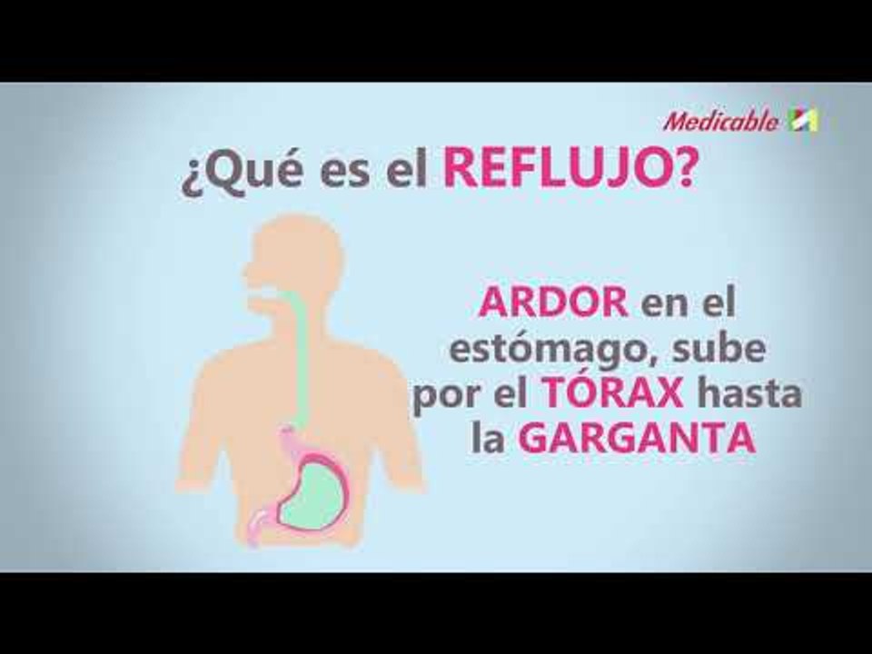 ¿QUÉ ES EL REFLUJO?