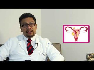 MIOMAS EN EL ÚTERO. Síntomas y Tratamiento