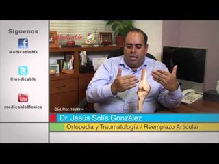 ¿Cómo está compuesta la articulación natural de la rodilla?