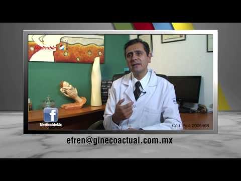 El uso del DIU, ¿influye para desarrollar sangrado menstrual abundante?