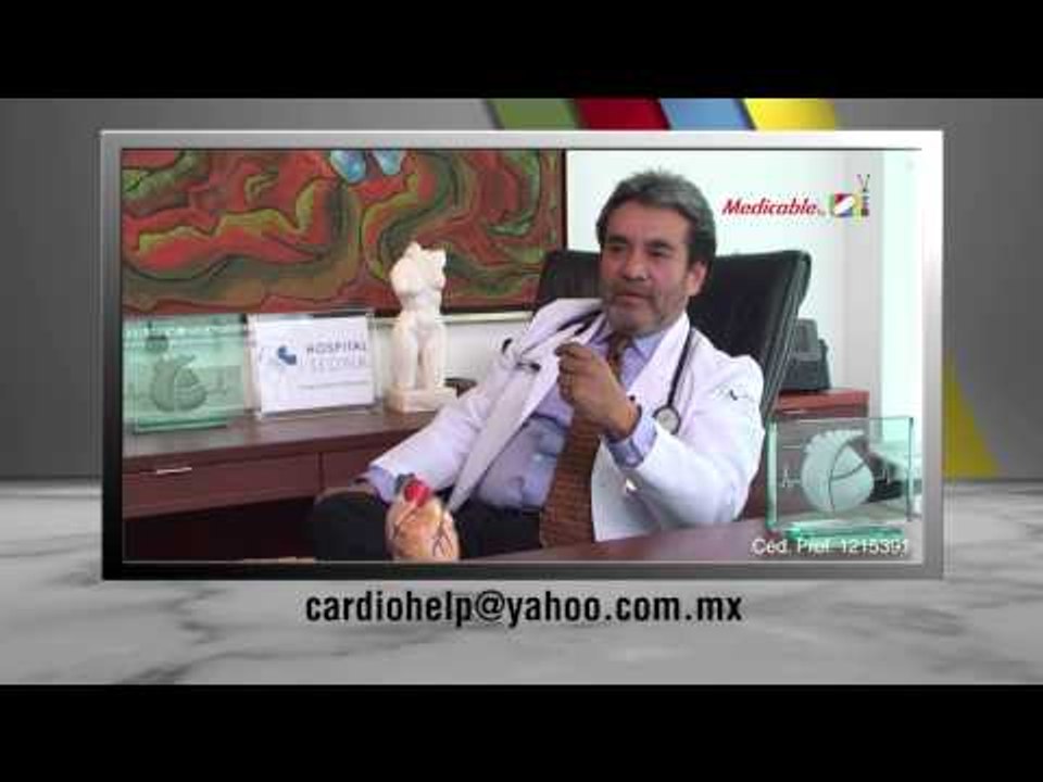 ¿La actividad física es buena para prevenir un infarto agudo al miocardio?