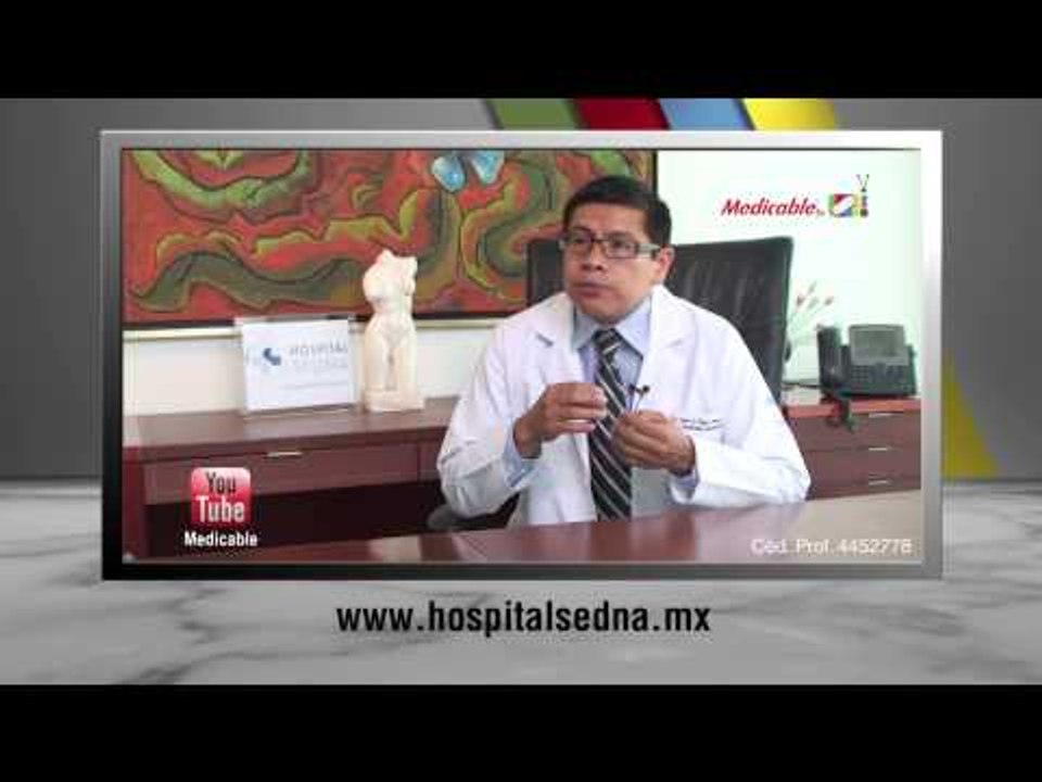 ¿Cómo pueden prevenirse los pólipos en colon?