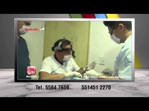 ¿Cómo se realiza una rinoseptumplastía?