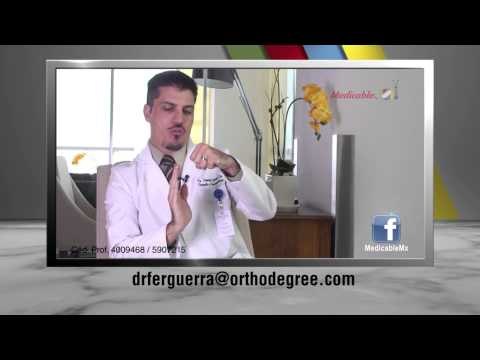 008 DR GUERRA QUE PAPEL JUEGAN LAS PROTESIS EN LA ARTROSIS DE HOMBRO