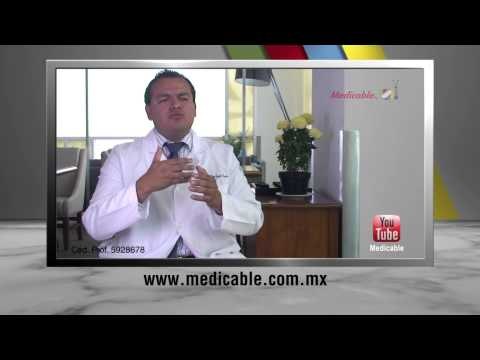 007 DR GAYTAN QUE ES Y COMO FUNCIONA UN BY PASS GASTRICO