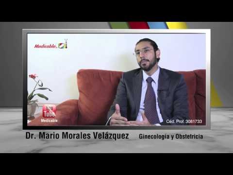 ¿Cuál es el tratamiento para la endometriosis?