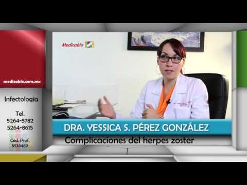 ¿Cuáles son las complicaciones si no se trata adecuadamente el herpes zoster?