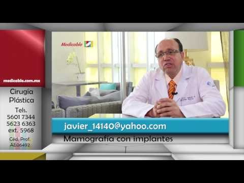004 PUEDO HACERME UNA MAMOGRAFIA EN UN FUTURO AUNQUE TENGA IMPLANTE