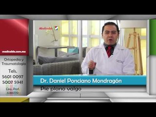 ¿Qué es el pie plano valgo?