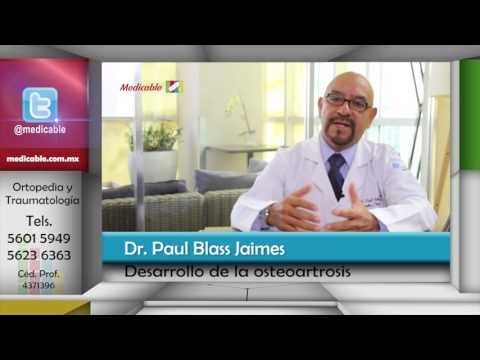 003 QUIENES ESTAN EN RIESGO DE DESARROLLAR OSTEOARTROSIS