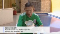Mexican man builds his own prosthetic leg for $4