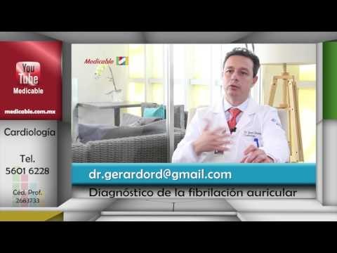 ¿Cómo se diagnostica la fibrilación auricular?