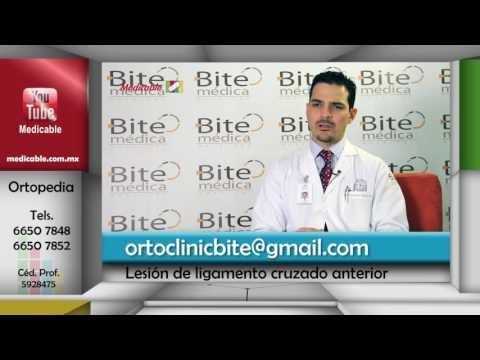 ¿Por qué buscar a un especialista cuando se sospecha de un desgarre de ligamento cruzado anterior?
