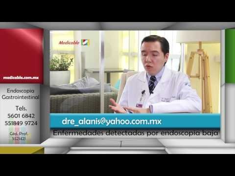 ¿Qué enfermedades se pueden detectar con la endoscopia baja o colonoscopia?