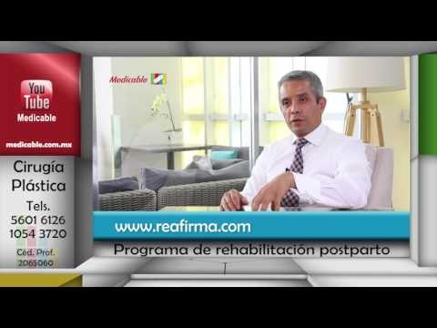 006 EN QUE AYUDA EL PROGRAMA DE REHABILITACION POSTPARTO