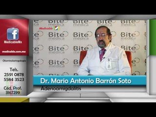 ¿Existen repercusiones a otras áreas del organismo con la adenoamigdalitis?