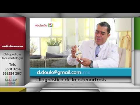 005 COMO SE DIAGNOSTICA LA OSTEOARTROSIS