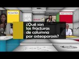 001 QUE SON LAS FRACTURAS DE LA COLUMNA POR OSTEOPOROSIS