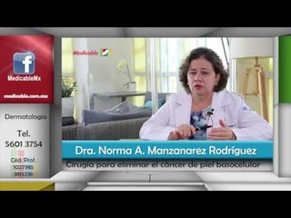 ¿Se requiere una preparación previa a la cirugía para el cáncer basocelular?