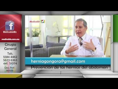 009 COMO PUEDEN PREVENIRSE LAS HERNIAS DEL ABDOMEN
