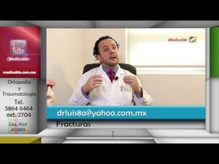 013 CUALES SON LOS RETOS ACTUALES EN EL MANEJO DE LAS FRACTURAS