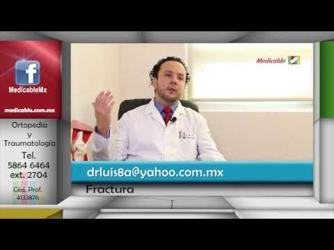 004 QUE ES LO QUE NO SE DEBE HACER ANTE UNA FACTURA