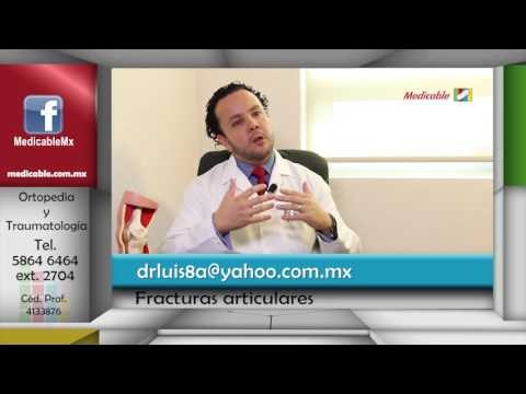 008 LAS FRACTURAS ARTICULARES EN JOVENES QUE TAN FRECUENTES SON